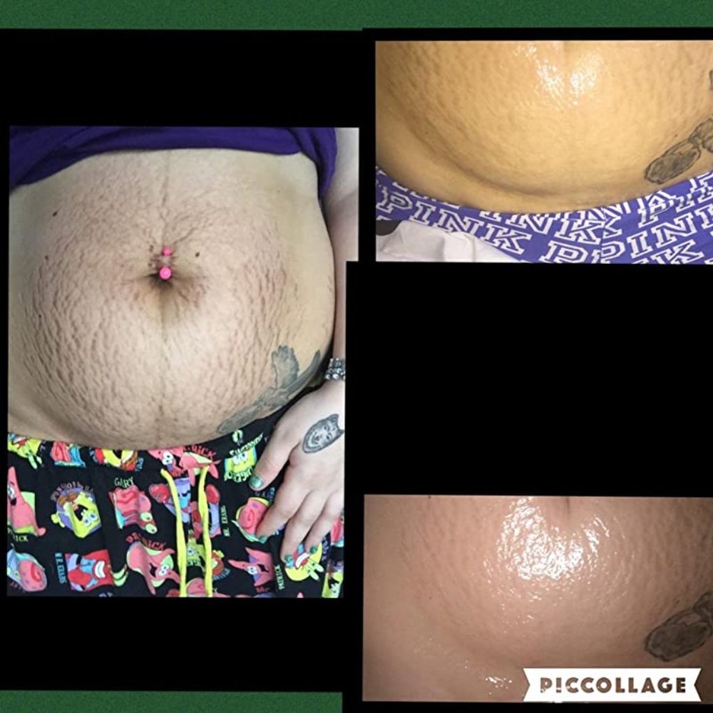 Bio Oil - Picture 10 of 10